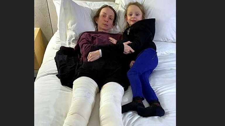 Viktoriia Stelmashchuk, 36, with her 4-year-old daughter, Marharyta. Viktoriia broke both...