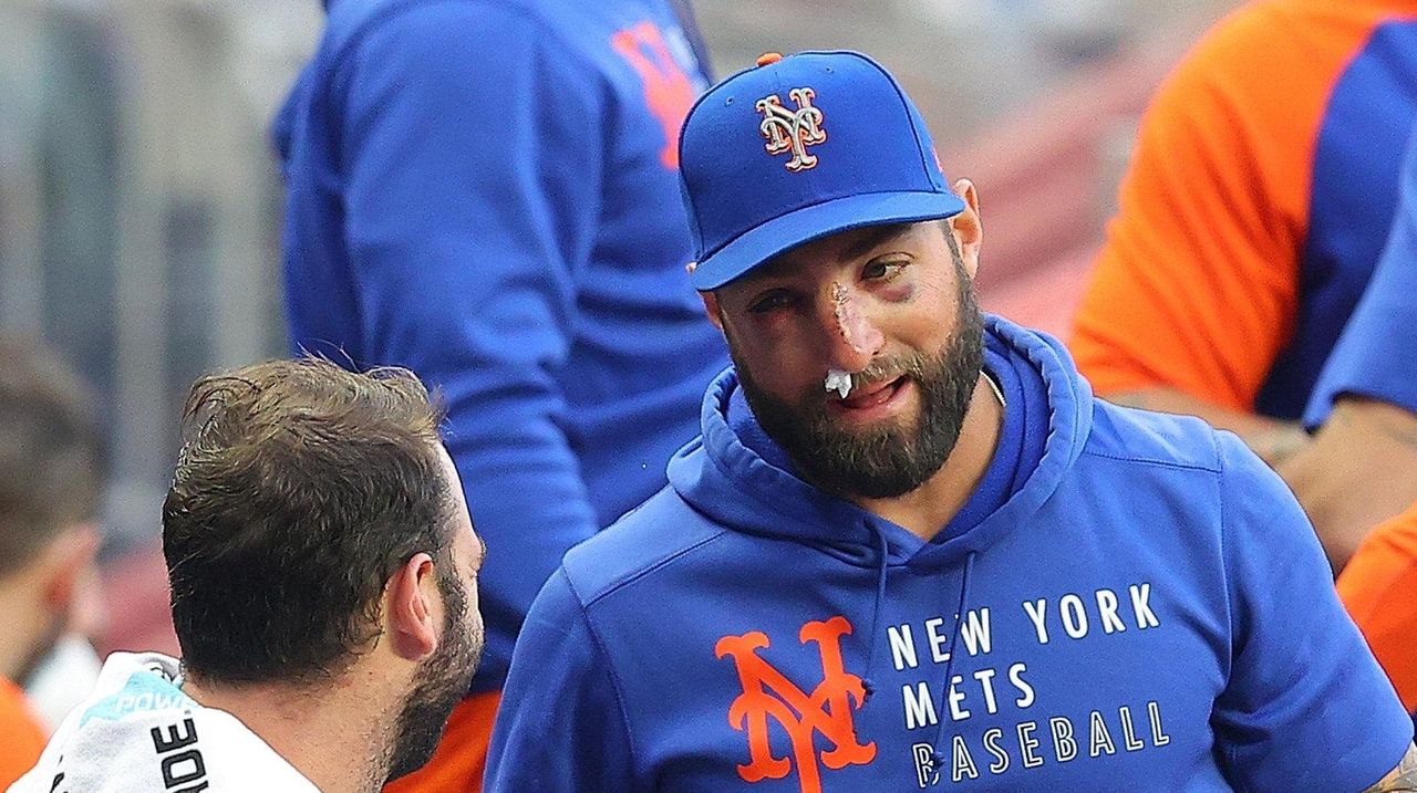 Mets outfielder Kevin Pillar undergoes surgery to repair his badly broken  nose - Newsday