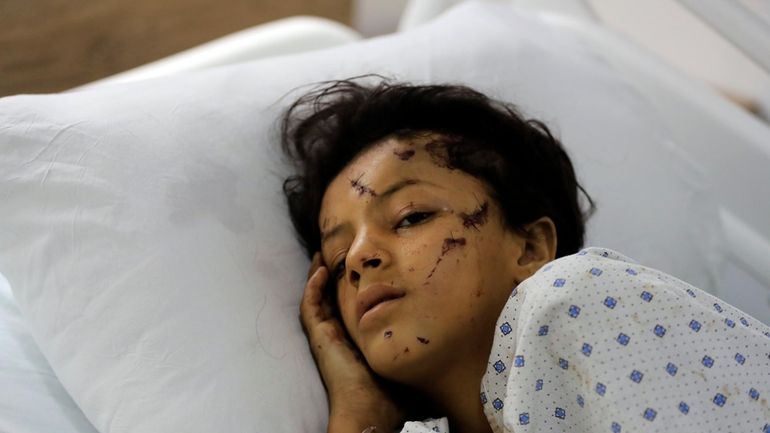 A wounded girl lies in a hospital bed in the...