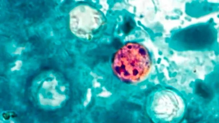 What to know about the cyclosporiasis parasite outbreak