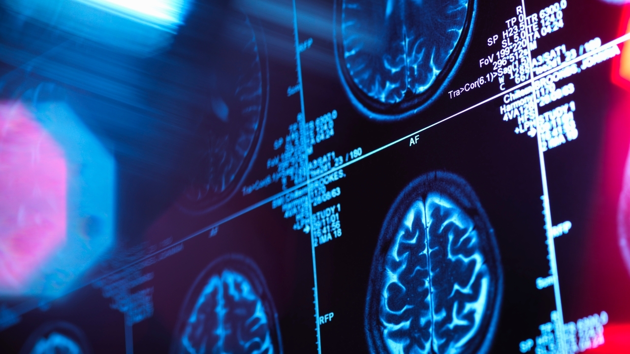 AI is helping us read minds, but should we? - Vimarsana News