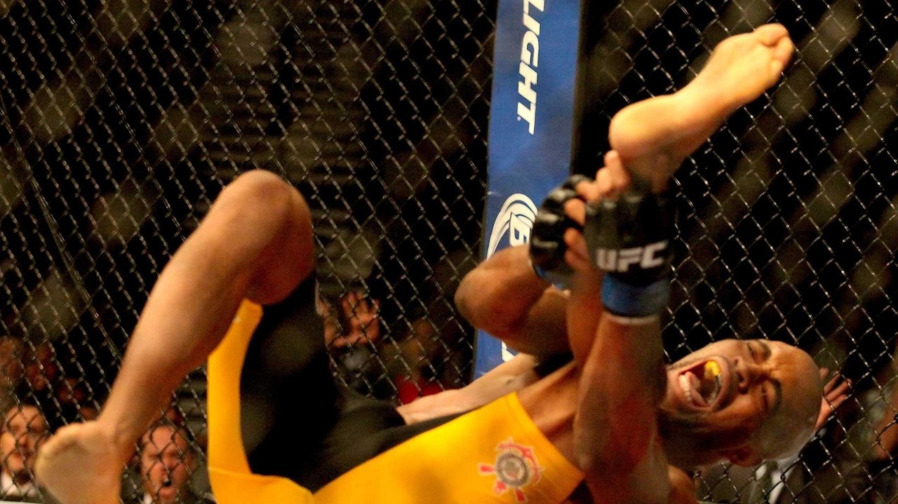 Former UFC champ Anderson Silva has surgery on broken leg - Newsday
