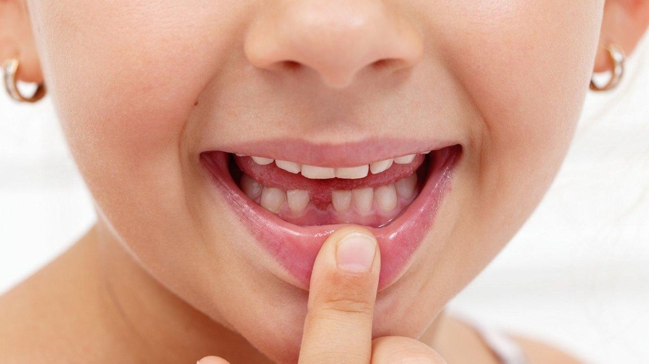 Can baby teeth and wisdom teeth be stored for stemcell use later