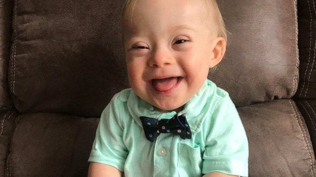 The real Down syndrome ‘problem’ Newsday