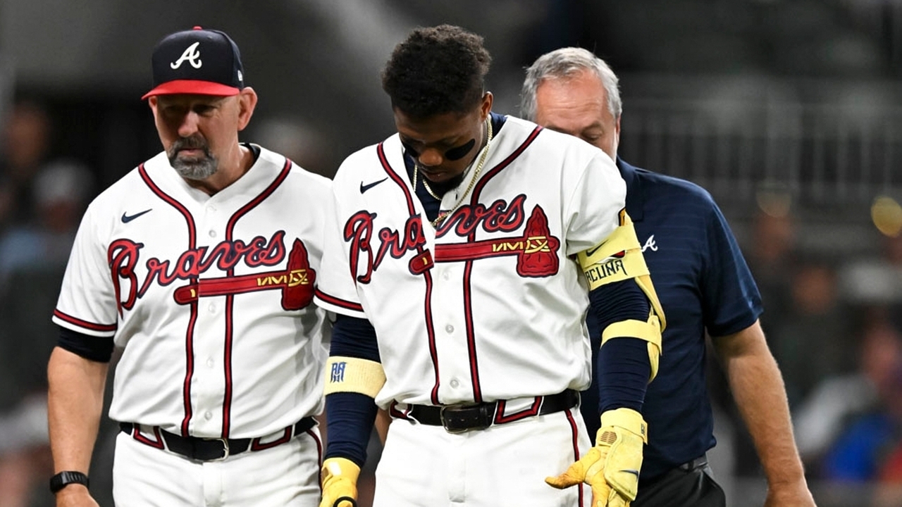 Braves' star Acuña day-to-day after fouling ball off left leg - Newsday