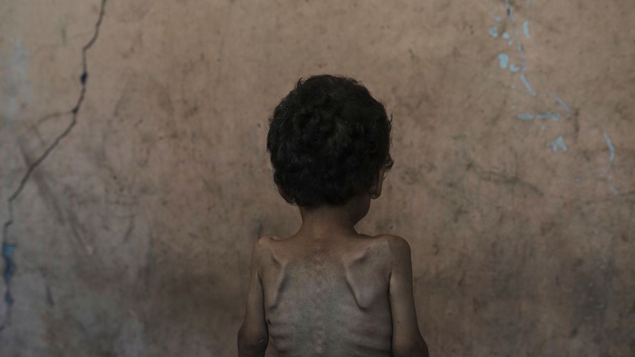 'Worst-case scenario of famine' is happening in Gaza, food crisis ...