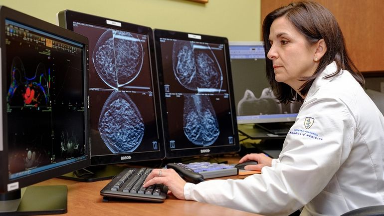 Dr. Nina Vincoff, chief of breast imaging at Northwell Health...