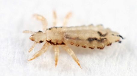 When it comes to head lice, business is