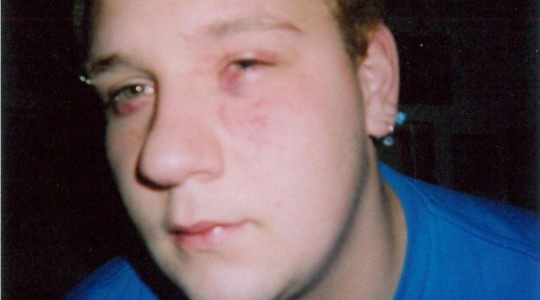 A Suffolk jury has awarded $3.6 million to