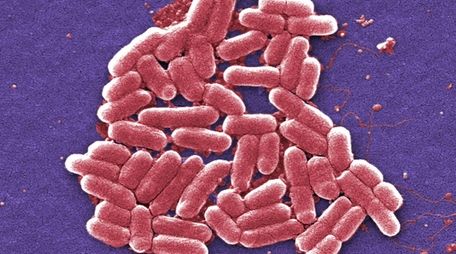 This 2006 colorized scanning electron micrograph image made