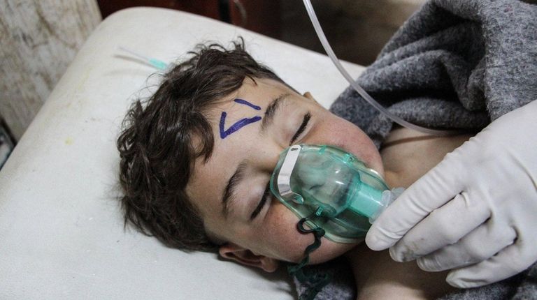 A child receives treatment after a chemical attack