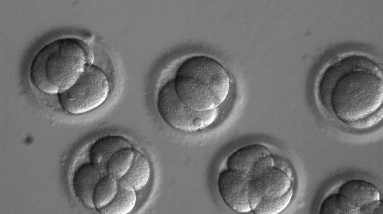 In this photo taken through a microscope, human