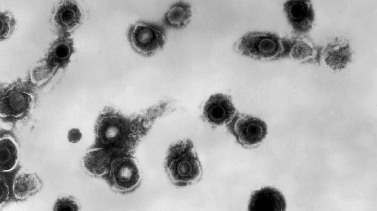 This 1981 electron microscope image made available by
