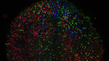 A magnified image of the oganoid retinal tissue,