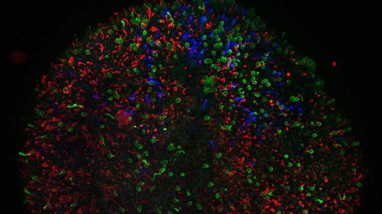 A magnified image of the oganoid retinal tissue,