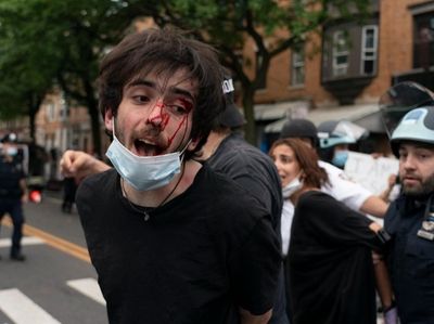 A bloodied protester is arrested as demonstrators demanding