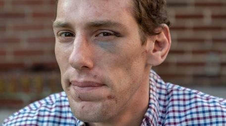 Joseph Borgen of Lawrence, who was beaten and